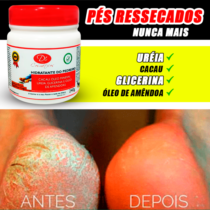 Creme Hidratante De Uréia 240g Creme De Pedreiro Pés Rachados E Ressecados